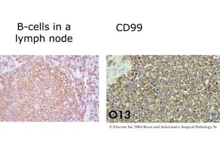 B-cells in a
lymph node
CD99
 