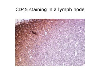 CD45 staining in a lymph node
 