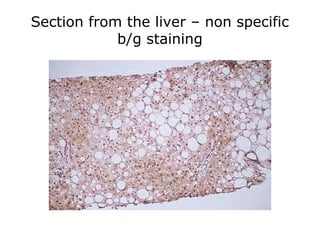 Section from the liver – non specific
b/g staining
 