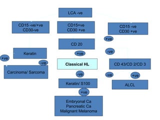LCA -ve
CD15+ve
CD30 +ve
CD 20
Classical HL
CD15 -ve/+ve
CD30-ve
CD 43/CD 2/CD 3
Keratin/ S100 ALCL
Embryonal Ca
Pancreatic Ca
Malignant Melanoma
CD15 -ve
CD30 +ve
+ve
+ve
-ve
+ve-ve
+ve
-ve
Keratin
Carcinoma/ Sarcoma
+ve
-ve
 