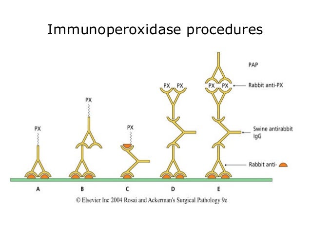 immunohistochemistry immunohistochemistry