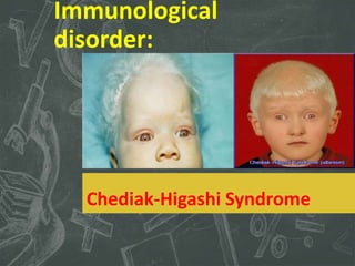 Immunological
disorder:
Chediak-Higashi Syndrome
 