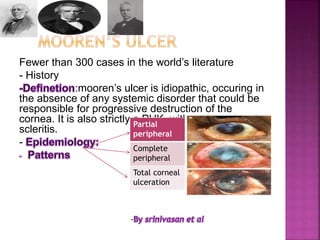 Fewer than 300 cases in the world’s literature
- History
:mooren’s ulcer is idiopathic, occuring in
the absence of any systemic disorder that could be
responsible for progressive destruction of the
cornea. It is also strictly a PUK, with no associated
scleritis.
-
Partial
peripheral
Complete
peripheral
Total corneal
ulceration
-
 