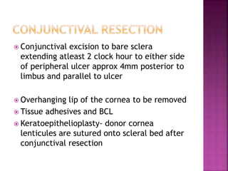  Conjunctival excision to bare sclera
extending atleast 2 clock hour to either side
of peripheral ulcer approx 4mm posterior to
limbus and parallel to ulcer
 Overhanging lip of the cornea to be removed
 Tissue adhesives and BCL
 Keratoepithelioplasty- donor cornea
lenticules are sutured onto scleral bed after
conjunctival resection
 