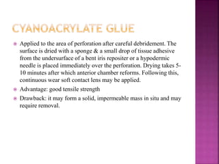  Applied to the area of perforation after careful debridement. The
surface is dried with a sponge & a small drop of tissue adhesive
from the undersurface of a bent iris repositer or a hypodermic
needle is placed immediately over the perforation. Drying takes 5-
10 minutes after which anterior chamber reforms. Following this,
continuous wear soft contact lens may be applied.
 Advantage: good tensile strength
 Drawback: it may form a solid, impermeable mass in situ and may
require removal.
 