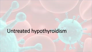 Untreated hypothyroidism
 