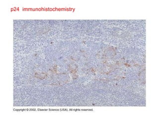 p24  immunohistochemistry 