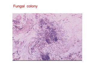 Fungal  colony 