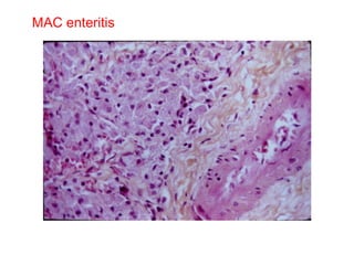 MAC enteritis 