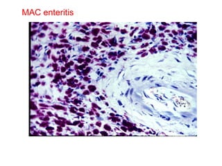 MAC enteritis 
