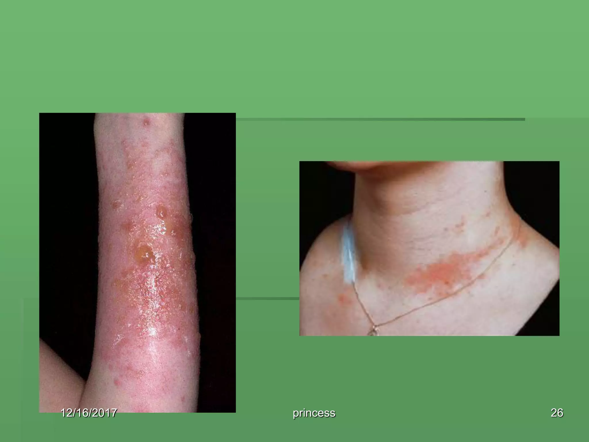 12/16/2017 26princess
 