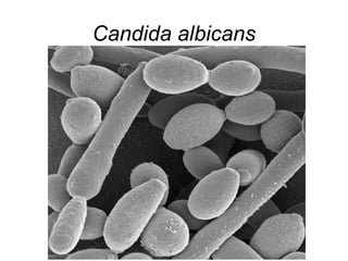 Candida albicans

 