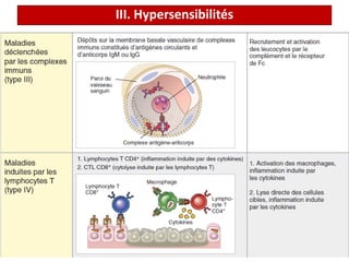 III. Hypersensibilités
 