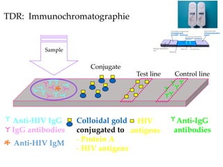 Sample
Conjugate
Control line
Test line
Anti-HIV IgG
IgG antibodies
Colloidal gold
conjugated to
- Protein A
- HIV antigens
Anti-IgG
antibodies
HIV
antigens
TDR: Immunochromatographie
Anti-HIV IgM
 