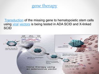 Scid Rv severe combined immunodeficiency | PPTX