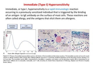 Immediate (Type I) Hypersensitivity
Immediate, or type I, hypersensitivity is a rapid immunologic reaction
occurring in a previously sensitized individual that is triggered by the binding
of an antigen to IgE antibody on the surface of mast cells. These reactions are
often called allergy, and the antigens that elicit them are allergens.
 
