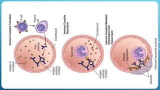 Comprehensive Overview of Major Histocompatibility Complex and Immune ...