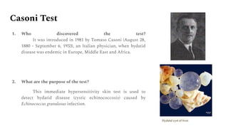 Casoni Test
1. Who discovered the test?
It was introduced in 1981 by Tomaso Casoni (August 28,
1880 - September 6, 1933), an Italian physician, when hydatid
disease was endemic in Europe, Middle East and Africa.
2. What are the purpose of the test?
This immediate hypersensitivity skin test is used to
detect hydatid disease (cystic echinococcosis) caused by
Echinococcus granulosus infection.
Hydatid cyst of liver.
 
