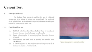 Casoni Test
3. Principle of the test
The hydatid ﬂuid (antigen) used in this test is collected
from a cyst of an animal or human and is sterilized. The sterilized
fresh hydatid ﬂuid is intradermally injected on one arm and equal
volume of saline on the other arm.
4. Procedure of the test
A. 0.20-0.25 ml of sterilized fresh hydatid ﬂuid is introduced
into the forearm of an individual intradermally
B. Equal volume saline is administered on the other forearm
(Control)
C. Observations are made after 30 minutes and another after
24-74 hours.
D. A wheal response at the injection site usually within 20-30
minutes indicates a positive result
Typical skin reaction in a positive Casoni Test.
 