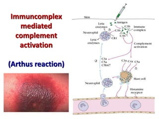 Immuncomplex
mediated
complement
activation
(Arthus reaction)
 