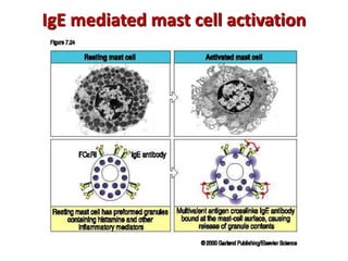 IgE mediated mast cell activation
 