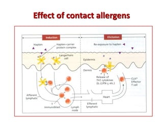 Effect of contact allergens
 