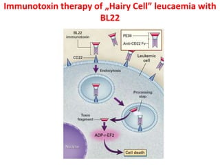Immunotoxin therapy of „Hairy Cell” leucaemia with
BL22
 