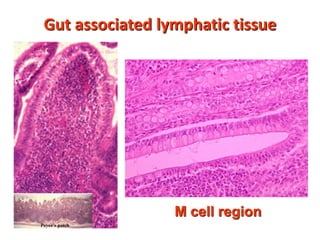 Gut associated lymphatic tissue
M cell region
 