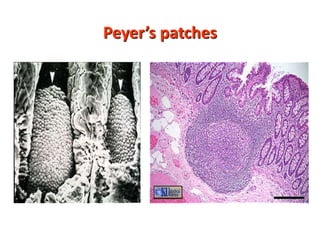 Peyer’s patches
 