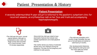 Patient Presentation & History
A severely undernourished 4-year-old girl is referred to the paediatric outpatient clinic for
recurrent anaemia, an erythematous rash on her face and trunk and accompanying
hepatosplenomegally.
Patient Presentation
•The child was born term, normal
vaginal delivery. Although no
complications were noted, her
Apgar scores were recorded
as 5, 6 and 8 at birth, 5 and
10 minutes respectively.
•Since birth the child was noted to have
dysmorphic features that include most
notably hypertelorism and small palpebral
fissures.
•Her mother denies any history of antenatal
alcohol use or any infections during her
pregnancy. This was the first pregnancy and
child born to both parents.
•The child was breastfed until 4
months of age; thereafter she was
put on formula feeds and started on
solid food by 9 months.
•Her developmental milestones
were delayed for both gross and
fine motor skills and verbal
development.
 
