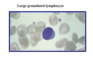 Large granulated lymphocyte 