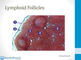 Lymphoid Follicles
Gleiberg/Wikipedia
 