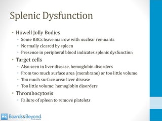 Splenic Dysfunction
• Howell Jolly Bodies
• Some RBCs leave marrow with nuclear remnants
• Normally cleared by spleen
• Presence in peripheral blood indicates splenic dysfunction
• Target cells
• Also seen in liver disease, hemoglobin disorders
• From too much surface area (membrane) or too little volume
• Too much surface area: liver disease
• Too little volume: hemoglobin disorders
• Thrombocytosis
• Failure of spleen to remove platelets
 