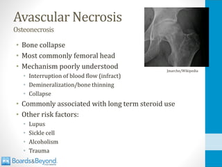 Avascular Necrosis
Osteonecrosis
• Bone collapse
• Most commonly femoral head
• Mechanism poorly understood
• Interruption of blood flow (infract)
• Demineralization/bone thinning
• Collapse
• Commonly associated with long term steroid use
• Other risk factors:
• Lupus
• Sickle cell
• Alcoholism
• Trauma
Jmarchn/Wikipedia
 