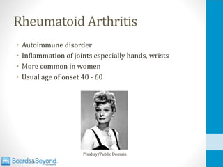 Rheumatoid Arthritis
• Autoimmune disorder
• Inflammation of joints especially hands, wrists
• More common in women
• Usual age of onset 40 - 60
Pixabay/Public Domain
 