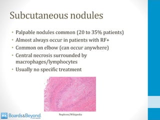 Subcutaneous nodules
• Palpable nodules common (20 to 35% patients)
• Almost always occur in patients with RF+
• Common on elbow (can occur anywhere)
• Central necrosis surrounded by
macrophages/lymphocytes
• Usually no specific treatment
Nephron/Wikipedia
 