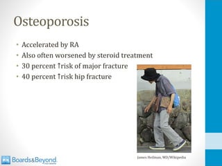 Osteoporosis
• Accelerated by RA
• Also often worsened by steroid treatment
• 30 percent ↑risk of major fracture
• 40 percent ↑risk hip fracture
James Heilman, MD/Wikipedia
 