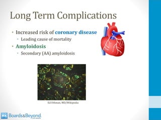 Long Term Complications
• Increased risk of coronary disease
• Leading cause of mortality
• Amyloidosis
• Secondary (AA) amyloidosis
Ed Uthman, MD/Wikipedia
 