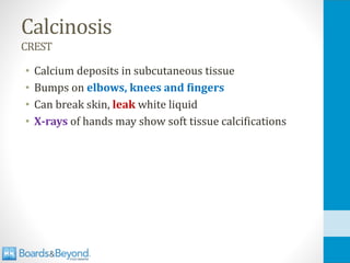 Calcinosis
CREST
• Calcium deposits in subcutaneous tissue
• Bumps on elbows, knees and fingers
• Can break skin, leak white liquid
• X-rays of hands may show soft tissue calcifications
 