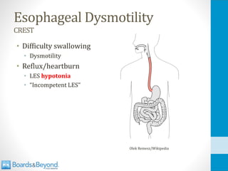 Esophageal Dysmotility
CREST
• Difficulty swallowing
• Dysmotility
• Reflux/heartburn
• LES hypotonia
• “Incompetent LES”
Olek Remesz/Wikipedia
 