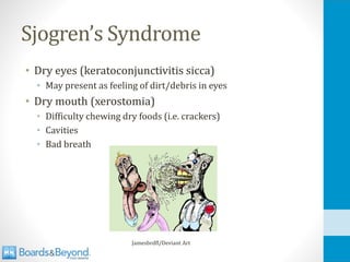 Sjogren’s Syndrome
• Dry eyes (keratoconjunctivitis sicca)
• May present as feeling of dirt/debris in eyes
• Dry mouth (xerostomia)
• Difficulty chewing dry foods (i.e. crackers)
• Cavities
• Bad breath
Jamesbrdfl/Deviant Art
 