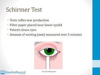 Schirmer Test
• Tests reflex tear production
• Filter paper placed near lower eyelid
• Patient closes eyes
• Amount of wetting (mm) measured over 5 minutes
Jmarchn/Wikipedia
 