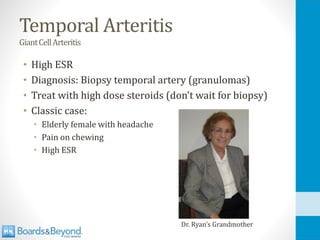 Temporal Arteritis
GiantCellArteritis
• High ESR
• Diagnosis: Biopsy temporal artery (granulomas)
• Treat with high dose steroids (don’t wait for biopsy)
• Classic case:
• Elderly female with headache
• Pain on chewing
• High ESR
Dr. Ryan’s Grandmother
 