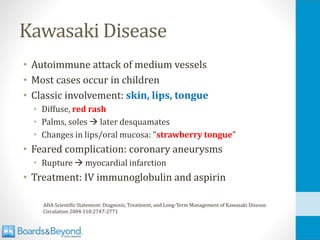 Kawasaki Disease
• Autoimmune attack of medium vessels
• Most cases occur in children
• Classic involvement: skin, lips, tongue
• Diffuse, red rash
• Palms, soles → later desquamates
• Changes in lips/oral mucosa: "strawberry tongue”
• Feared complication: coronary aneurysms
• Rupture → myocardial infarction
• Treatment: IV immunoglobulin and aspirin
AHA Scientific Statement: Diagnosis, Treatment, and Long-Term Management of Kawasaki Disease.
Circulation 2004:110:2747-2771
 