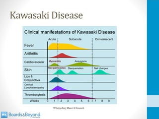 Kawasaki Disease
Wikipedia/ Maen K Househ
 