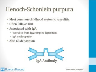 Henoch-Schonlein purpura
• Most common childhood systemic vasculitis
• Often follows URI
• Associated with IgA
• Vasculitis from IgA complex deposition
• IgA nephropathy
• Also C3 deposition
Martin Brändli /Wikipedia
IgA Antibody
 