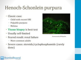 Henoch-Schonlein purpura
• Classic case:
• Child with recent URI
• Palpable purpura
• Melena
• Tissue biopsy is best test
• Usually self-limited
• Feared result: renal failure
• More common adults
• Severe cases: steroids/cyclophosphamide (rarely
done)
Emmanuelm/Wikipedia
 