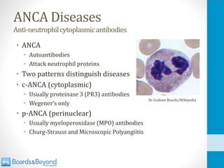 ANCA Diseases
Anti-neutrophilcytoplasmicantibodies
• ANCA
• Autoantibodies
• Attack neutrophil proteins
• Two patterns distinguish diseases
• c-ANCA (cytoplasmic)
• Usually proteinase 3 (PR3) antibodies
• Wegener’s only
• p-ANCA (perinuclear)
• Usually myeloperoxidase (MPO) antibodies
• Churg-Strauss and Microscopic Polyangiitis
Dr Graham Beards/Wikipedia
 