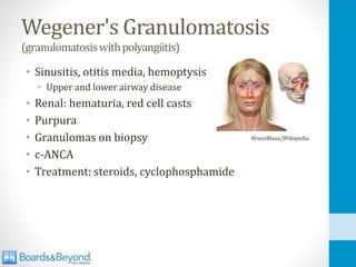 Wegener's Granulomatosis
(granulomatosiswithpolyangiitis)
• Sinusitis, otitis media, hemoptysis
• Upper and lower airway disease
• Renal: hematuria, red cell casts
• Purpura
• Granulomas on biopsy
• c-ANCA
• Treatment: steroids, cyclophosphamide
BruceBlaus/Wikipedia
 