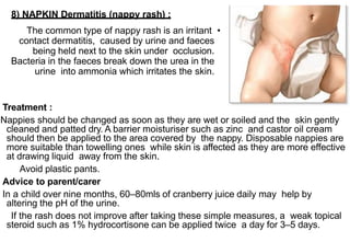 Napkin Rash Immunology of skin diseases dr.ihsan alsaimary | PPTX